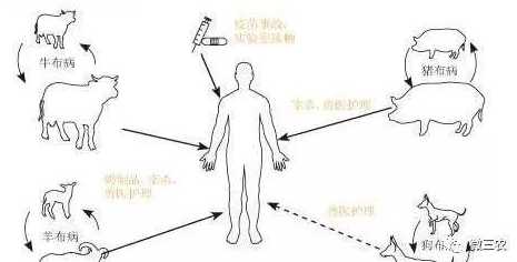 布病怎样治疗