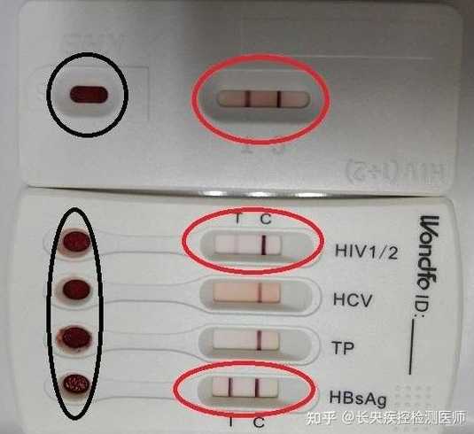 疾控中心试纸检测一定准吗