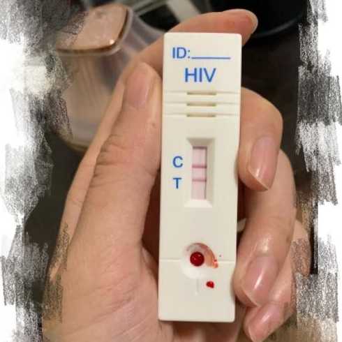 HIV初筛阳性结果是不是感染了艾滋病?有何意义?