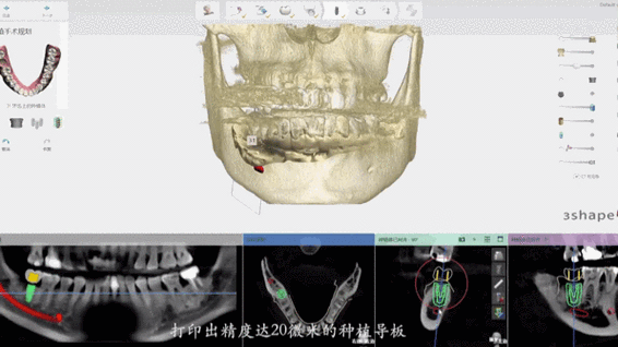 请问哪里可以查询到全球关于新冠疫情动态?